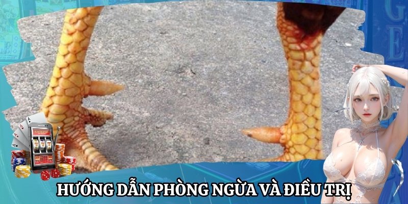 Nguyên nhân phổ biến dẫn đến Vảy Gà Vấn Cán